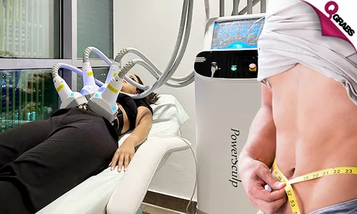 Laser Lipolysis for Ladies & Men at Energy Zone!